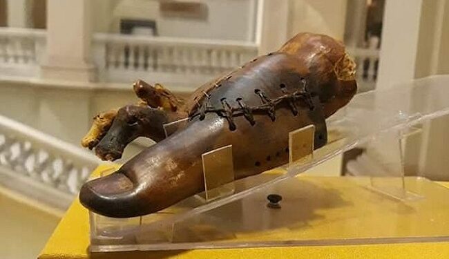 1ère prothèse et 2ème squelette humain en Egypte 1 - Le Progrès Egyptien