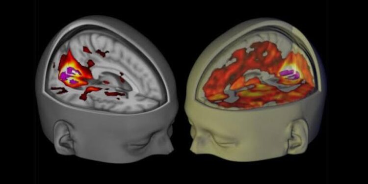 Pourquoi les effets hallucinogènes du LSD durent si longtemps ? 2 - Le Progrès Egyptien Pourquoi les effets hallucinogènes du LSD durent si longtemps ? 1 - Le Progrès Egyptien