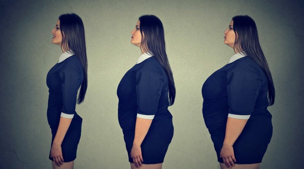 Chirurgie bariatrique :quelles en sont les solutions ? 1 - Le Progrès Egyptien