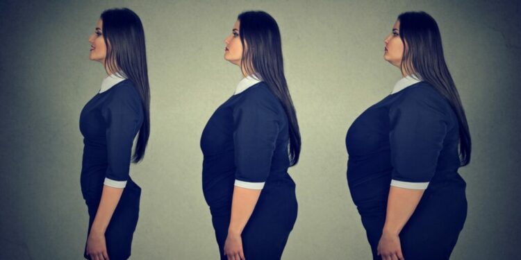 Chirurgie bariatrique :quelles en sont les solutions ? 1 - Le Progrès Egyptien