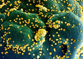 Covid : Un quart des formes sévères s’explique par des anomalies