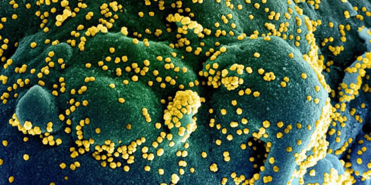 Covid : Un quart des formes sévères s’explique par des anomalies 1 - Le Progrès Egyptien