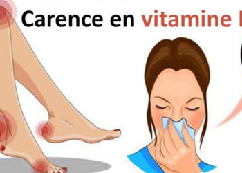 Vitamine D : Que risque-t-on en cas de carence ?