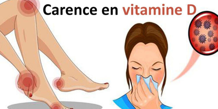 Vitamine D : Que risque-t-on en cas de carence ? 1 - Le Progrès Egyptien
