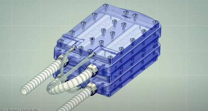 Le premier rein artificiel dans le corps humain 1 - Le Progrès Egyptien