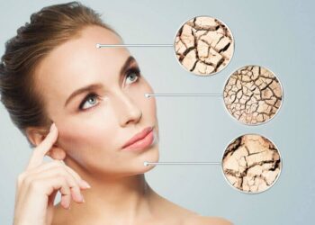 Peau sèche : que faire pour la nourrir ?