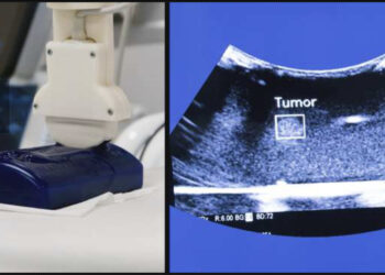 Les robots chirurgicaux seront autonomes