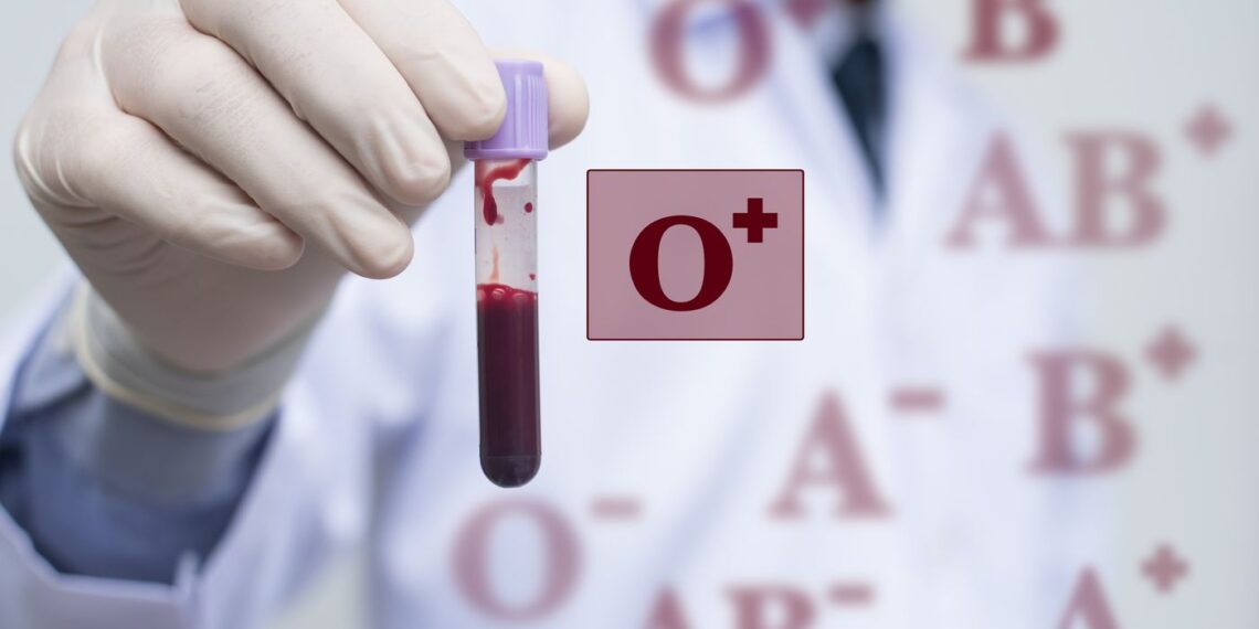Male doctor or tecnichian holding red blood (fresh whole blood) in test tube and blood group icon, blood group O Rh positive. Blood donation concept.