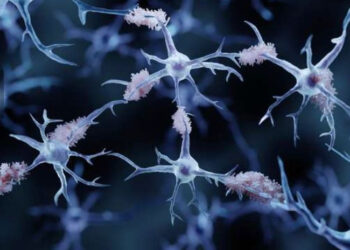 Maladie d’Alzheimer : 75 facteurs de risques génétiques ont été identifiés