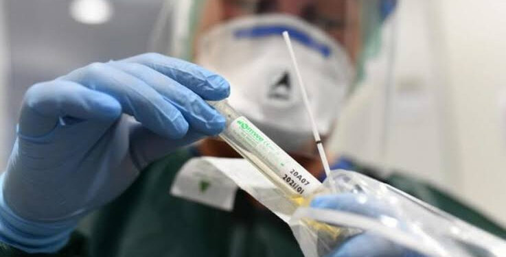 Variole du singe : Un laboratoire développe des tests PCR de détection du virus 1 - Le Progrès Egyptien