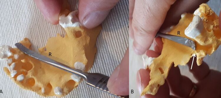 La Dent de la Momie 1 - Le Progrès Egyptien