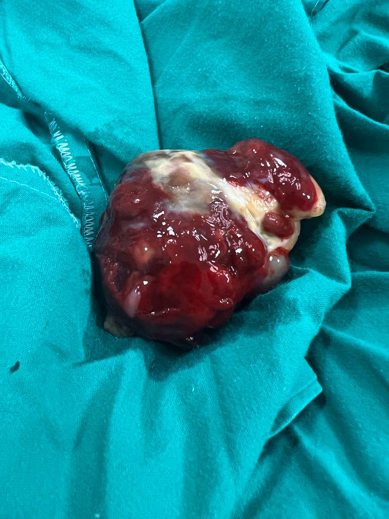 Maladie cardiaque : L'université d'Assiout réalise une grande réussite 6 - Le Progrès Egyptien Maladie cardiaque : L'université d'Assiout réalise une grande réussite 5 - Le Progrès Egyptien