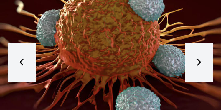 Un espoir pour le traitement du Cancer des ovaires 2 - Le Progrès Egyptien Un espoir pour le traitement du Cancer des ovaires 1 - Le Progrès Egyptien