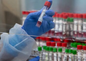 Pas de hausse du nombre d’enfants infectés par la variole à Assouan
