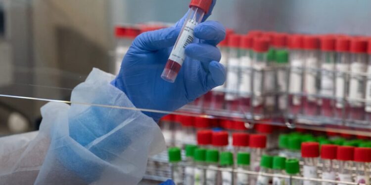 Pas de hausse du nombre d’enfants infectés par la variole à Assouan 1 - Le Progrès Egyptien