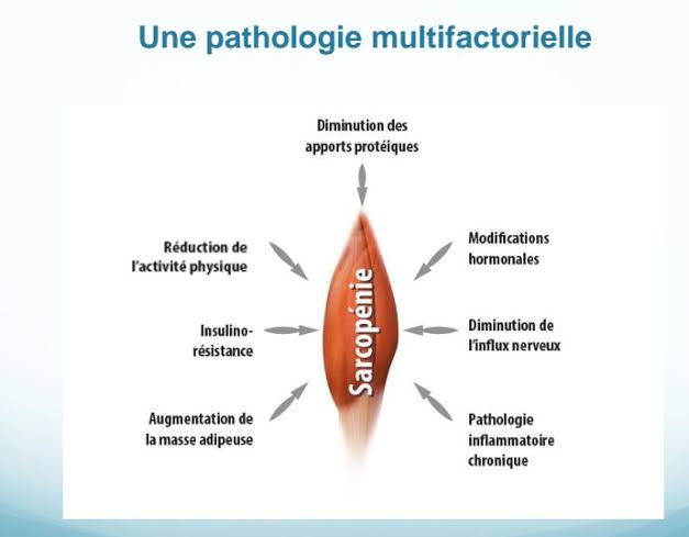 La sarcopénie : Le nouveau mal du siècle ? 9 - Le Progrès Egyptien