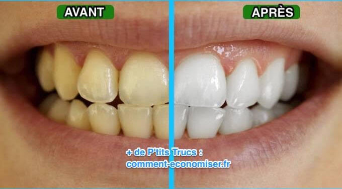 Le secret des dents blanches 1 - Le Progrès Egyptien