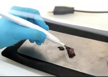 Le iknife pour détecter les cancers en quelques secondes 