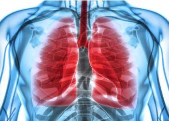 Un médicament réduit le risque de mourir d’un cancer du poumon