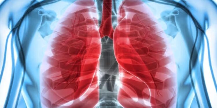 Un médicament réduit le risque de mourir d'un cancer du poumon 2 - Le Progrès Egyptien Un médicament réduit le risque de mourir d'un cancer du poumon 1 - Le Progrès Egyptien