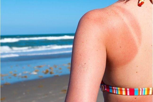 La trousse SOS naturelle à emporter en vacances 4 - Le Progrès Egyptien La trousse SOS naturelle à emporter en vacances 3 - Le Progrès Egyptien