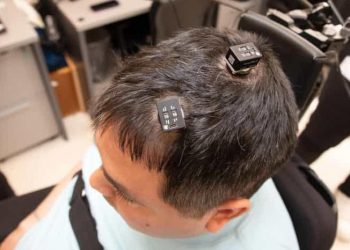 Des implants redonnent des sensations à un homme paralysé  