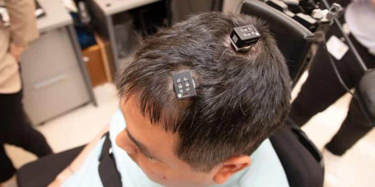Des implants redonnent des sensations à un homme paralysé 2 - Le Progrès Egyptien Des implants redonnent des sensations à un homme paralysé 1 - Le Progrès Egyptien