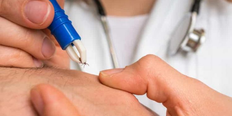 La bave de tique, une nouvelle génération de traitements  1 - Le Progrès Egyptien