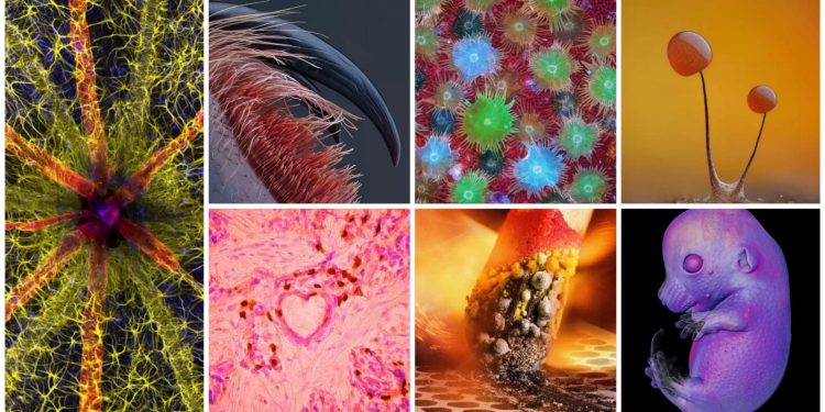 Nikon small world : Les plus belles photos microscopiques en 2023 2 - Le Progrès Egyptien Nikon small world : Les plus belles photos microscopiques en 2023 1 - Le Progrès Egyptien