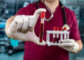 Al-Sissi accorde une grande attention au projet national de fabrication de dérivés du plasma