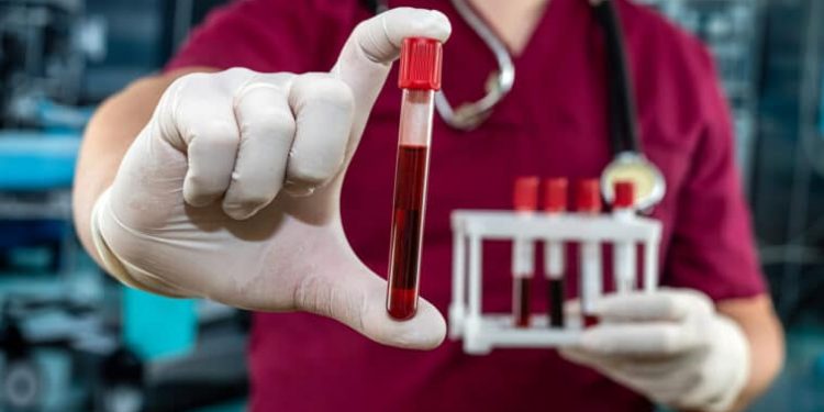 Al-Sissi accorde une grande attention au projet national de fabrication de dérivés du plasma 1 - Le Progrès Egyptien Doctor in red uniform holding blood in test tube for coronavirus in laboratory hospital.