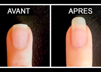 5 astuces pour faire pousser ses ongles plus rapidement