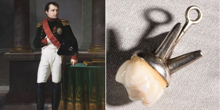 L’une des dents de Napoléon Ier aux enchères à Fontainebleau 2 - Le Progrès Egyptien L’une des dents de Napoléon Ier aux enchères à Fontainebleau 1 - Le Progrès Egyptien