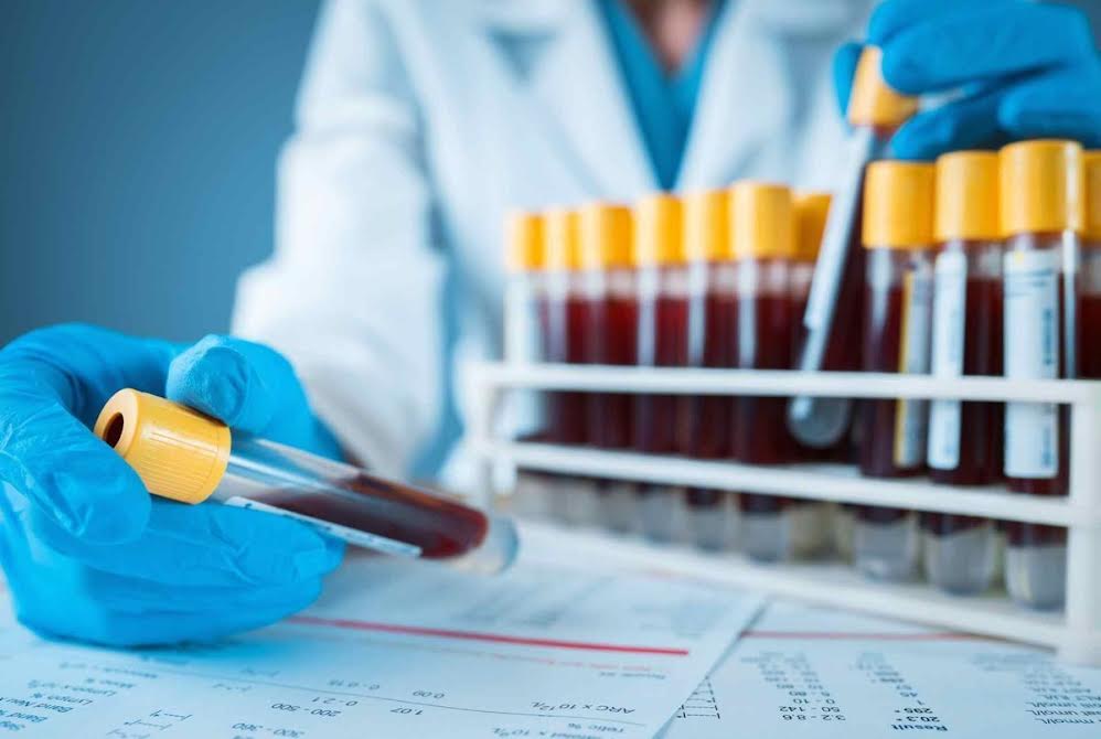 Votre santé, une priorité 6 - Le Progrès Egyptien Votre santé, une priorité 5 - Le Progrès Egyptien