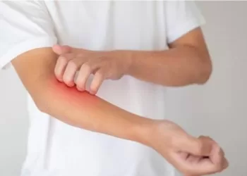 Démangeaisons: Comment apaiser le besoin de se gratter la peau ?