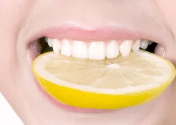 Comment avoir les dents blanches ?