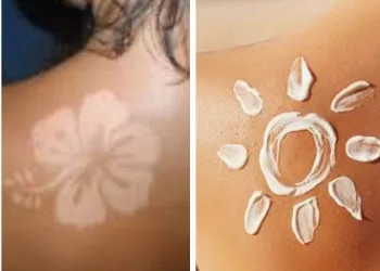 Tan lines, burn lines, Sun Tattoo:  Quand TikTok joue avec le feu