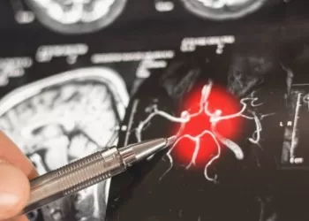 Alzheimer: Découverte d’un mécanisme inédit pour freiner la maladie